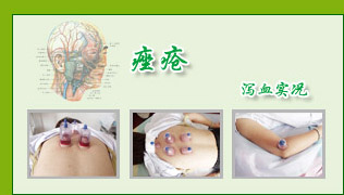 кѪƷ򵥣ЧԣƷʵԸߣĿռǿԾ׵ͻؽʹƼЧǳԡ